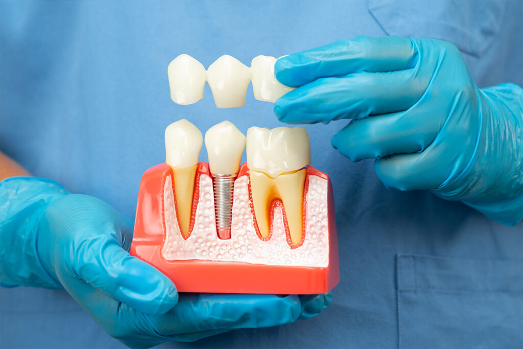 Restorative-Dentistry-