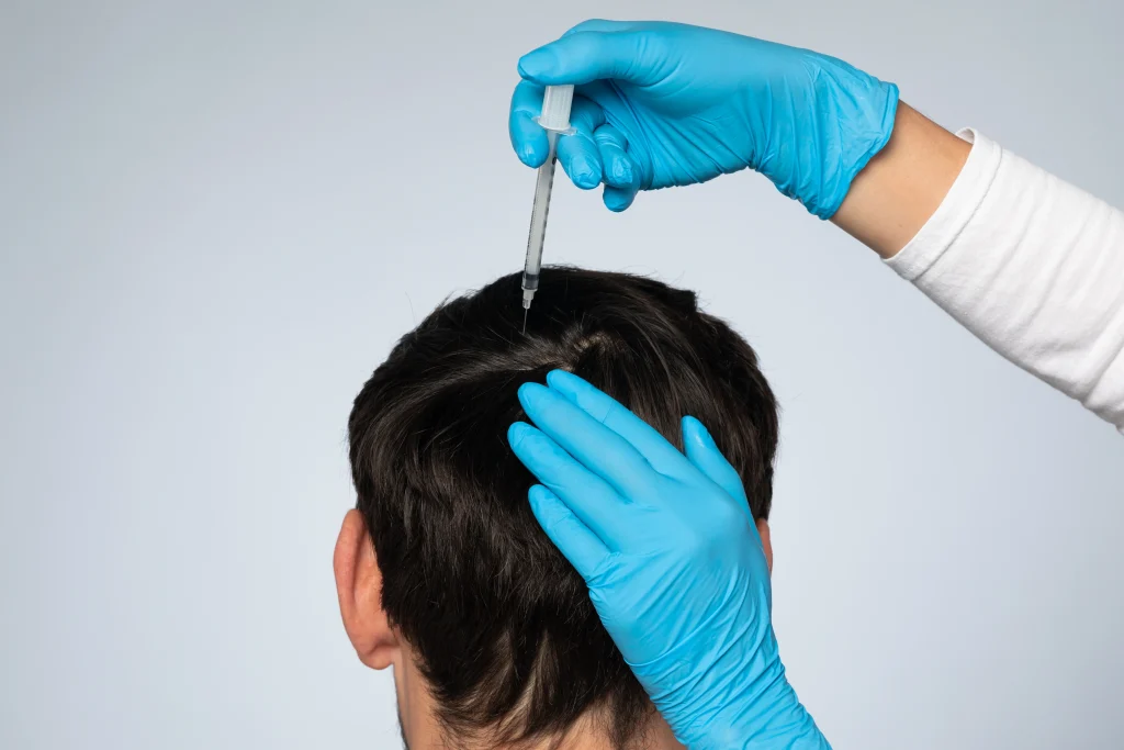Professional Hair PRP treatment in Abu Dhabi at First City Medical Center to stimulate hair growth and strengthen thinning hair