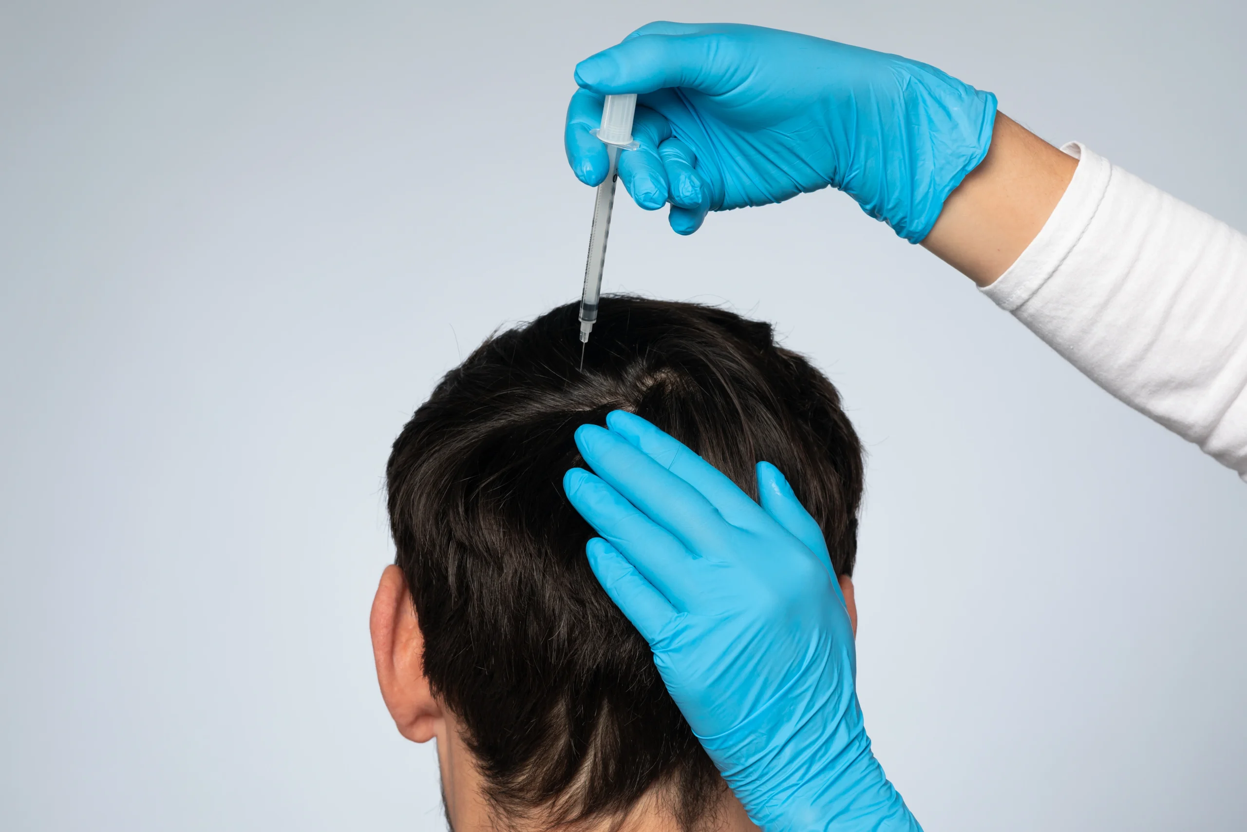 Professional Hair PRP treatment in Abu Dhabi at First City Medical Center to stimulate hair growth and strengthen thinning hair