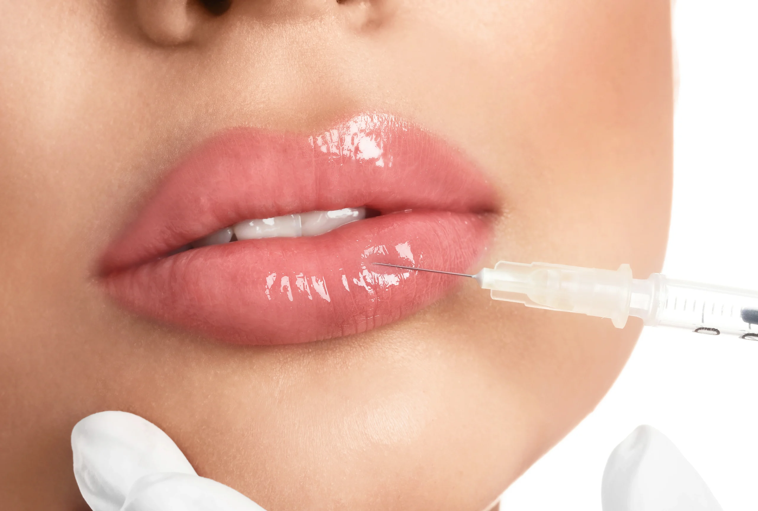 Dermal fillers and lip fillers treatment in Abu Dhabi at First City Medical Center