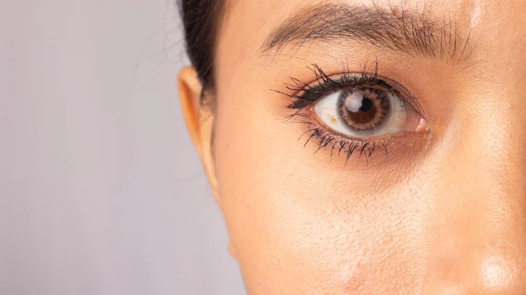 Dark circle treatment in Abu Dhabi at First City Medical Center